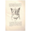 Traitement chirurgical de la ptose gastrique, O. Lambret 1929 - chirurgie gastrique, manuels de médecine, chirurgie