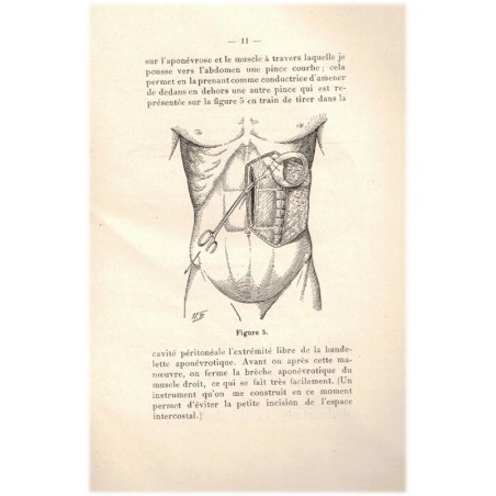 Traitement chirurgical de la ptose gastrique, O. Lambret 1929 - chirurgie gastrique, manuels de médecine, chirurgie