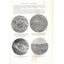 Allergie, Karl Hansen, 1943 - les allergies, manuels de médecine