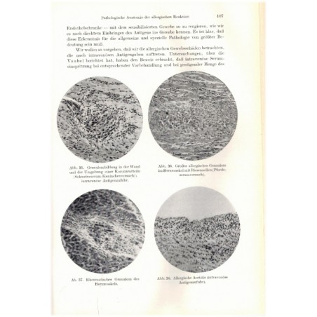 Allergie, Karl Hansen, 1943 - Medizin, Lehrbuch, maladie, manuels de médecine