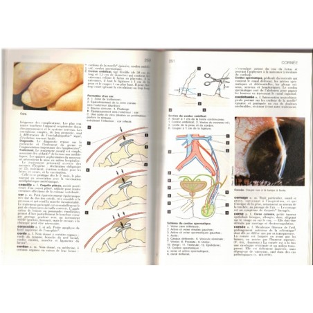 Dictionnaire médical T1, André Domart et Jacques Bourneuf, Larousse thématique 1984 - maladies, pharmacologie,  manuels médecine