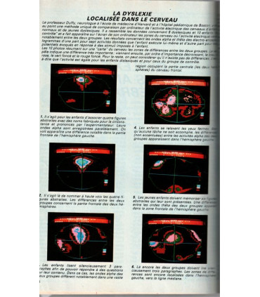 Bombe atomique, clonage poissons, dyslexie, génétique, robotique en 1980, poissons, - Science et Vie N°767 août 1981 -
